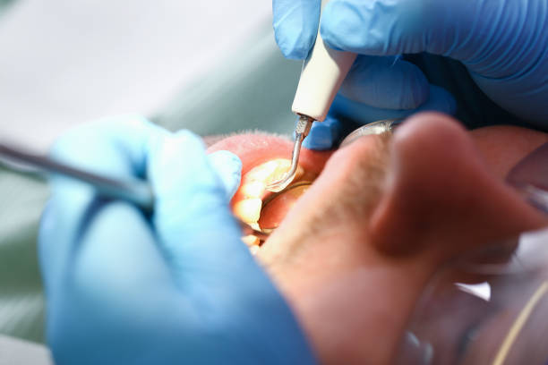 Best Knocked-Out Tooth Emergency  in Wellsboro, PA
