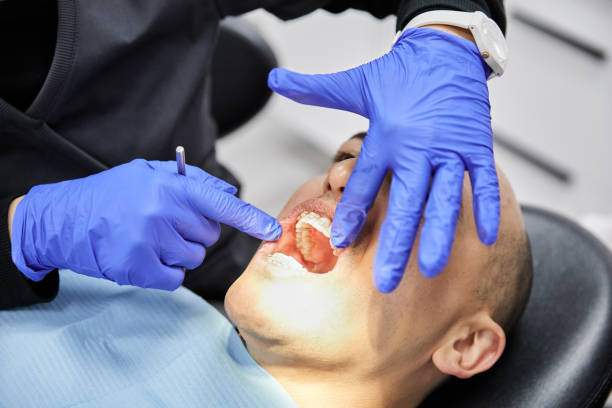Best Teeth Whitening  in Wellsboro, PA