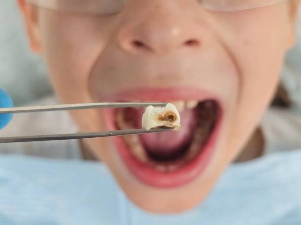 Best Tooth Pain Emergency Relief  in Wellsboro, PA